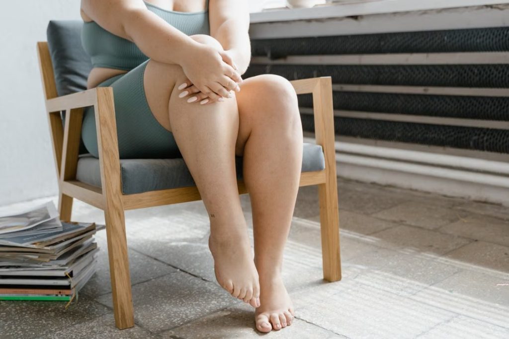 Why Understanding Lipedema Is the First Step Toward Greater Comfort and Confidence featured 22487